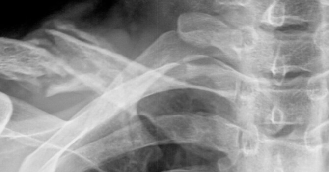 Chiropractic X-Rays
